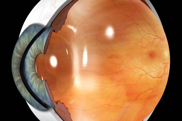 anatomia edema macular diabetico